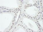 SRC1 Antibody in Immunohistochemistry (IHC)