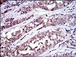 SRC Antibody in Immunohistochemistry (Paraffin) (IHC (P))