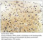 SRPK1 Antibody in Immunohistochemistry (IHC)