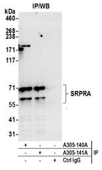 SRPRA/SRPR Antibody in Western Blot (WB)