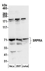 SRPRA/SRPR Antibody in Western Blot (WB)