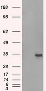 SRR Antibody in Western Blot (WB)