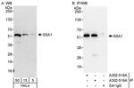 SSA1 Antibody in Western Blot (WB)