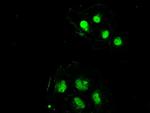 SSB Antibody in Immunocytochemistry (ICC/IF)