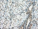 SSB Antibody in Immunohistochemistry (Paraffin) (IHC (P))