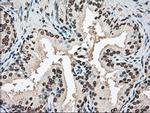 SSB Antibody in Immunohistochemistry (Paraffin) (IHC (P))