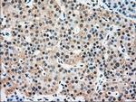 SSB Antibody in Immunohistochemistry (Paraffin) (IHC (P))