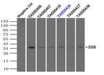 SSB Antibody in Immunoprecipitation (IP)