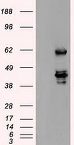 SSB Antibody in Western Blot (WB)