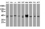 SSB Antibody in Western Blot (WB)