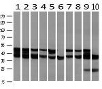 SSB Antibody in Western Blot (WB)