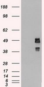 SSB Antibody in Western Blot (WB)