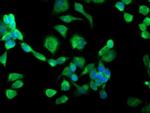 SSR1 Antibody in Immunocytochemistry (ICC/IF)