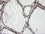 SSR1 Antibody in Immunohistochemistry (Paraffin) (IHC (P))