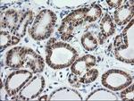 SSR1 Antibody in Immunohistochemistry (Paraffin) (IHC (P))