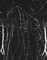 SSTR4 Antibody in Immunohistochemistry (IHC)