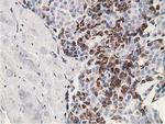 SSX1 Antibody in Immunohistochemistry (Paraffin) (IHC (P))