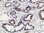 SSX1 Antibody in Immunohistochemistry (Paraffin) (IHC (P))