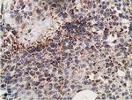 SSX1 Antibody in Immunohistochemistry (Paraffin) (IHC (P))