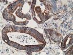 SSX1 Antibody in Immunohistochemistry (Paraffin) (IHC (P))