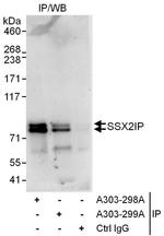 SSX2IP Antibody in Immunoprecipitation (IP)