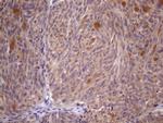 SSX2IP Antibody in Immunohistochemistry (Paraffin) (IHC (P))