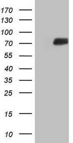 SSX2IP Antibody in Western Blot (WB)