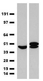 ST13 Antibody in Western Blot (WB)