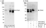 STAM1 Antibody in Western Blot (WB)