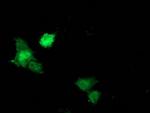 STAT5A Antibody in Immunocytochemistry (ICC/IF)