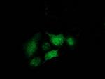 STAT5A Antibody in Immunocytochemistry (ICC/IF)