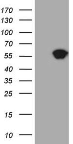 STAU1 Antibody in Western Blot (WB)