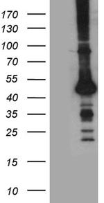 STBD1 Antibody in Western Blot (WB)