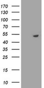 STK11 Antibody in Western Blot (WB)