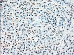 STK3 Antibody in Immunohistochemistry (Paraffin) (IHC (P))