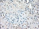 STK3 Antibody in Immunohistochemistry (Paraffin) (IHC (P))