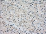 STK3 Antibody in Immunohistochemistry (Paraffin) (IHC (P))