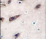 Syntaxin 3 Antibody in Immunohistochemistry (IHC)