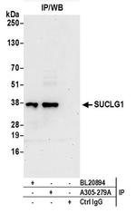 SUCLG1 Antibody in Western Blot (WB)