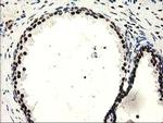 SULT1A1 Antibody in Immunohistochemistry (Paraffin) (IHC (P))