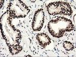 SULT1A1 Antibody in Immunohistochemistry (Paraffin) (IHC (P))