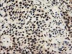 SULT1A1 Antibody in Immunohistochemistry (Paraffin) (IHC (P))