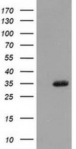 SULT1A1 Antibody in Western Blot (WB)