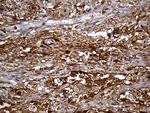 SULT1A3 Antibody in Immunohistochemistry (Paraffin) (IHC (P))