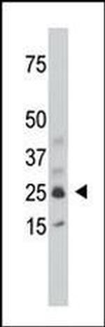 SULT1C2 Antibody in Western Blot (WB)