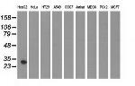 SULT2A1 Antibody in Western Blot (WB)