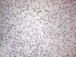 SUPT3H Antibody in Immunohistochemistry (Paraffin) (IHC (P))