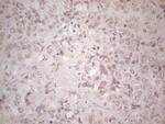 SUPT3H Antibody in Immunohistochemistry (Paraffin) (IHC (P))