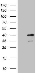 SUPT3H Antibody in Western Blot (WB)
