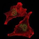 SUZ12 Antibody in Immunocytochemistry (ICC/IF)